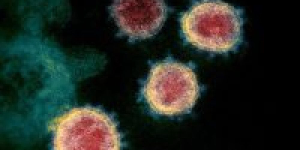Coronavirus: distribution AMAP à Treillières